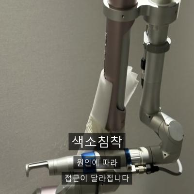 피부과색소침착, 원인별 치료 방법 총정리 이미지 1
