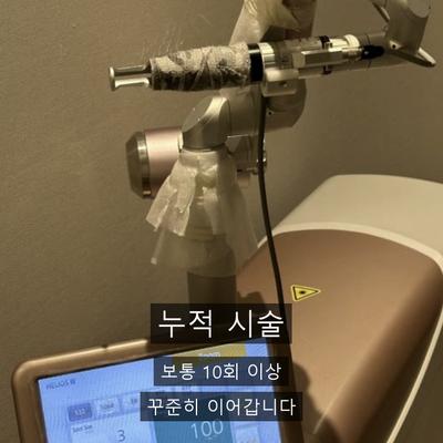 피부과색소침착, 원인별 치료 방법 총정리 이미지 6