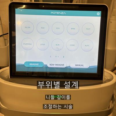 여드름흉터 치료기관을 고를 때 확인할 3가지 기준 이미지 4