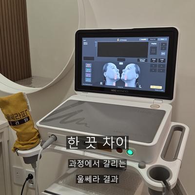 울쎄라 치료기관을 고를 때 확인할 기준 3가지 이미지 9