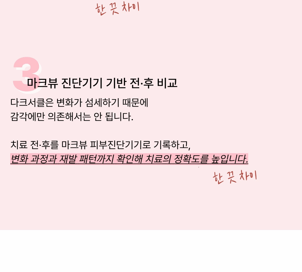 [칙칙한 눈밑을 밝히는] 다크서클 토닝 상세 이미지