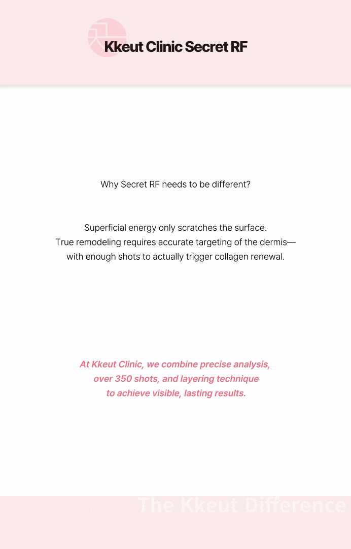 เลเซอร์ Secret RF [สำหรับรูขุมขน, รอยแผลเป็นจากสิว, ริ้วรอยเล็กๆ] 상세 이미지