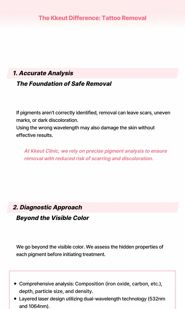 [ลบรอยสักกึ่งถาวร] ลบรอยสักอายไลเนอร์ 상세 이미지