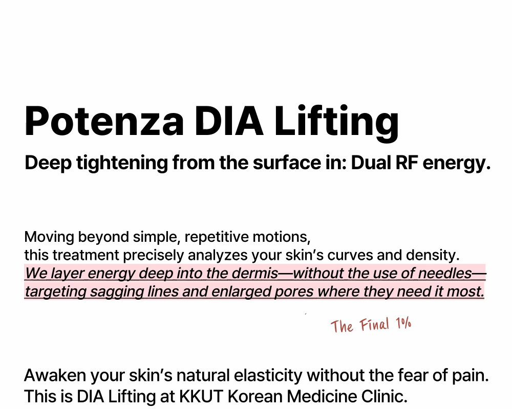 Potenza 钻石提升 상세 이미지