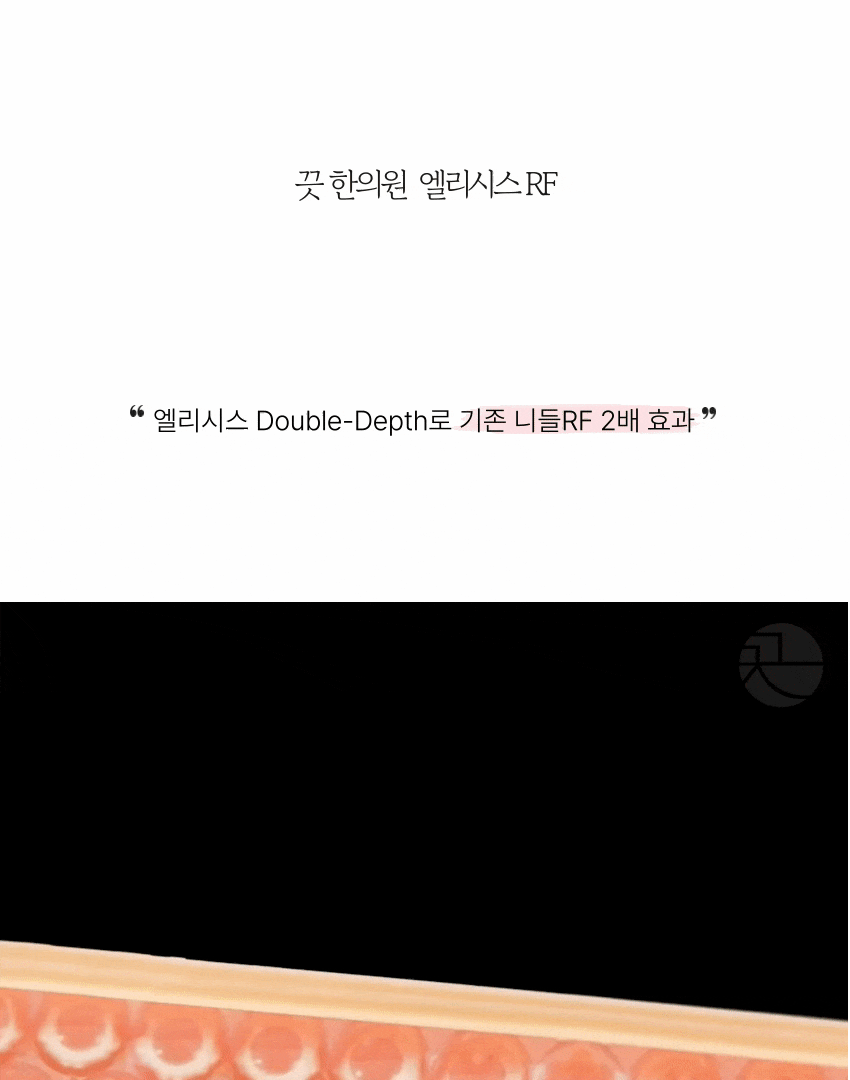 [기존 니들RF 2배 효과, 모공, 여드름 흉터] 엘리시스 RF 레이저