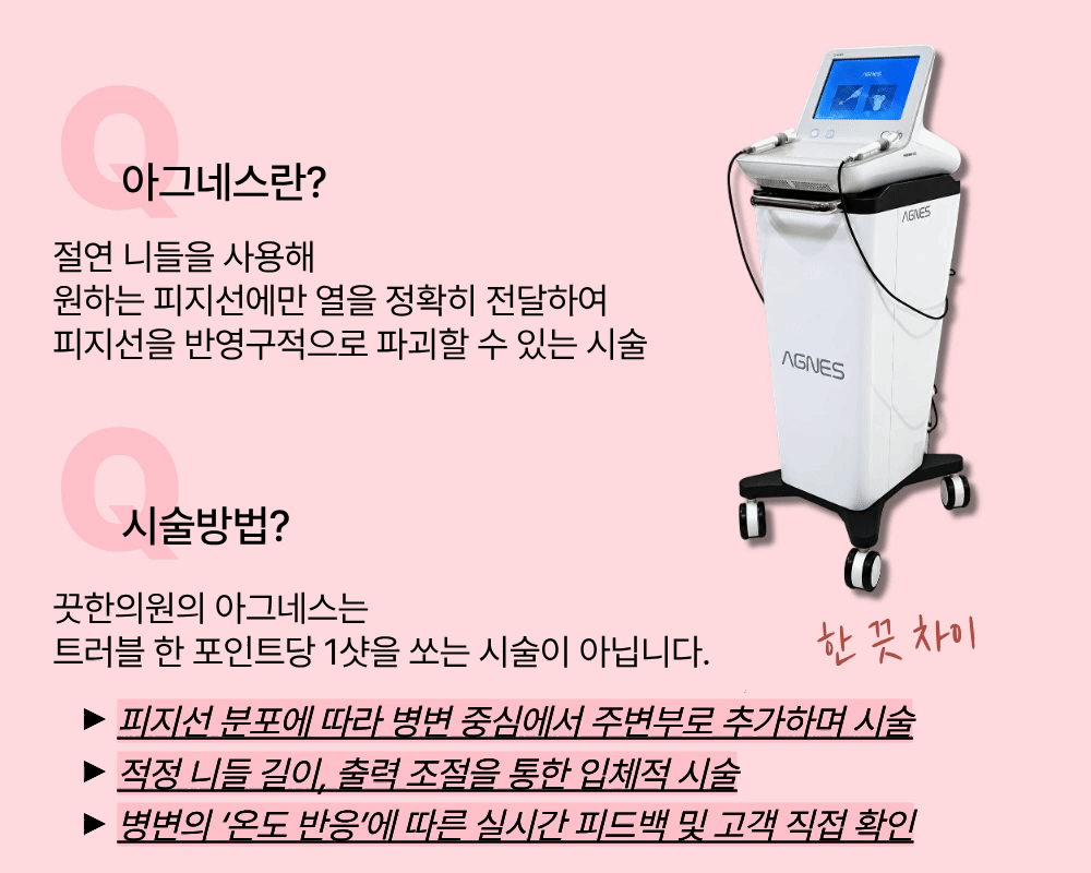 피지선 파괴 아그네스 | 이벤트 가격 9900원| 분당판교 끗한의원 이미지 4