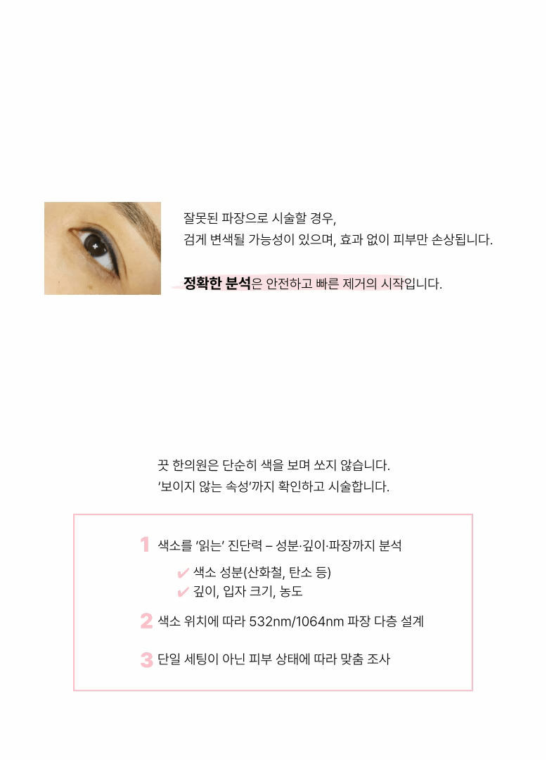 [타투 제거] 반영구 아이라인 문신 지우기 이미지 2