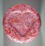 Heart molecular scheme