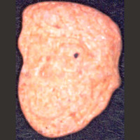 Trump molecular scheme