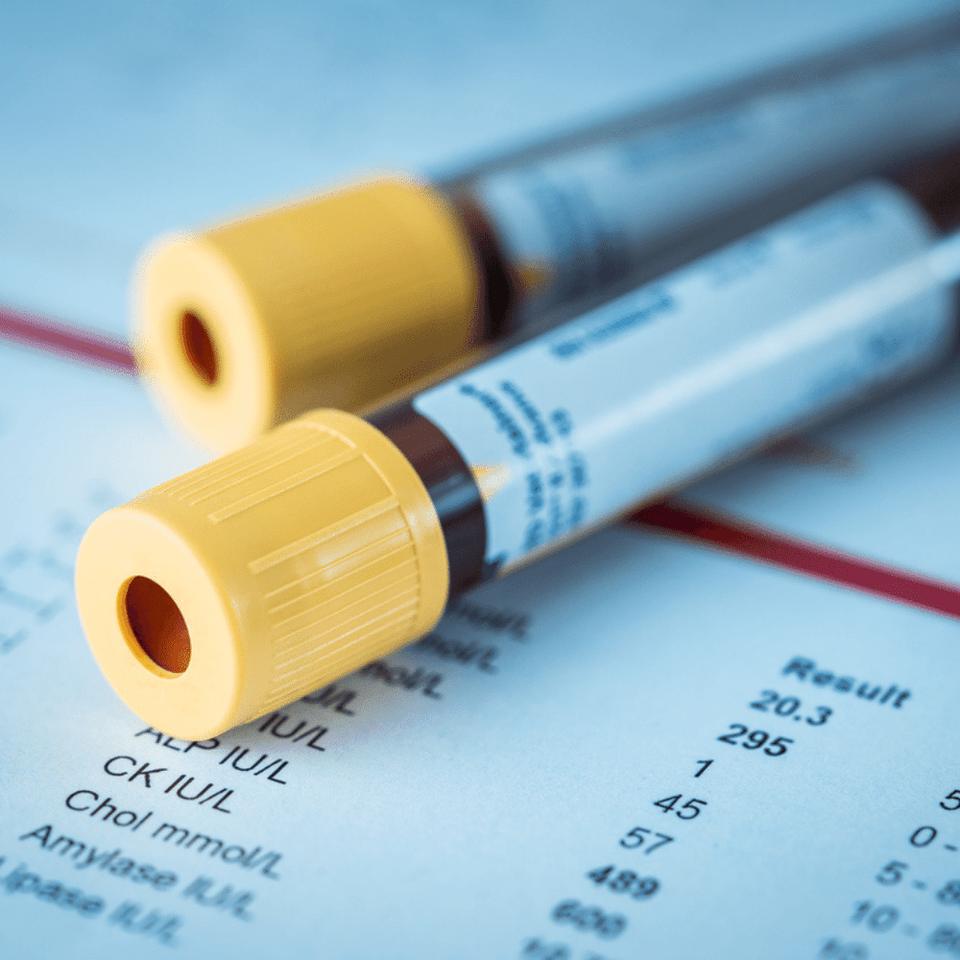 Blood vials to confirm a diagnosis