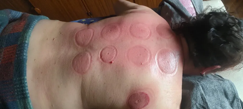 Dodir Duše- FarmLife Medicine-Terapija - 7