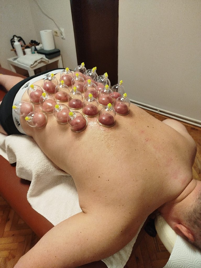 Masaža tela i kiropraktika - 4