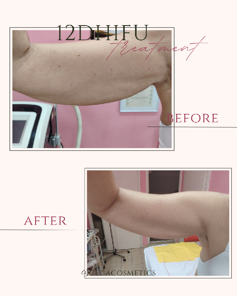 Cecacosmetics021 - 5