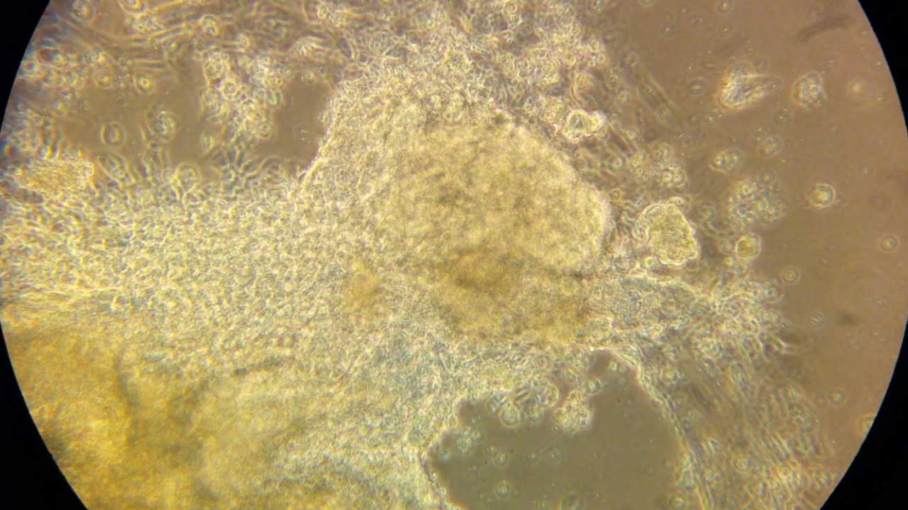 A dish of beating heart cells differentiated from embryonic stem cells