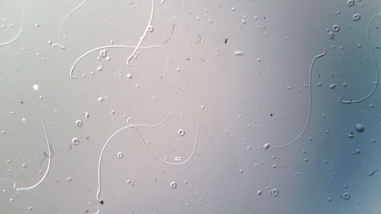 Sperm with hooks