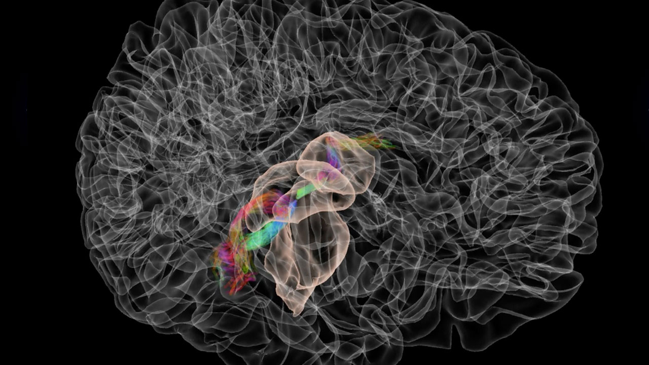 Virtual Brain: Auditory Pathways