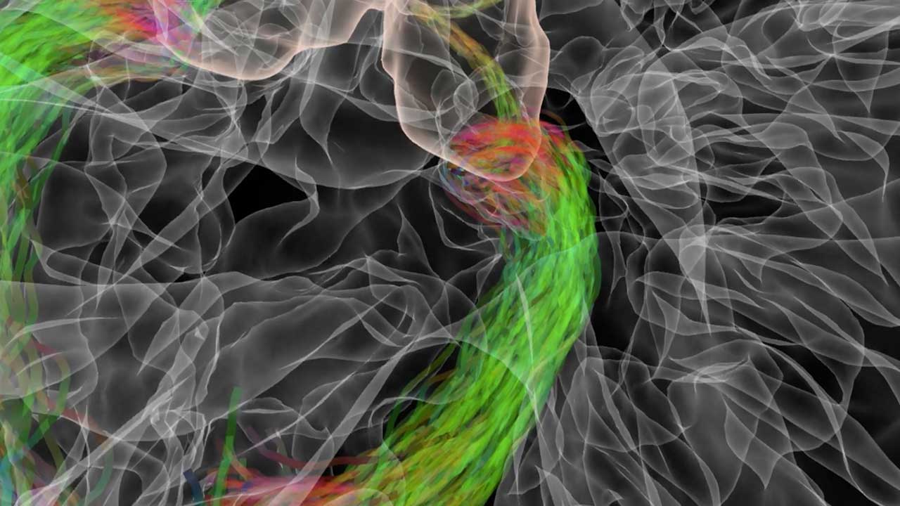 Virtual Brain: Visual Pathways