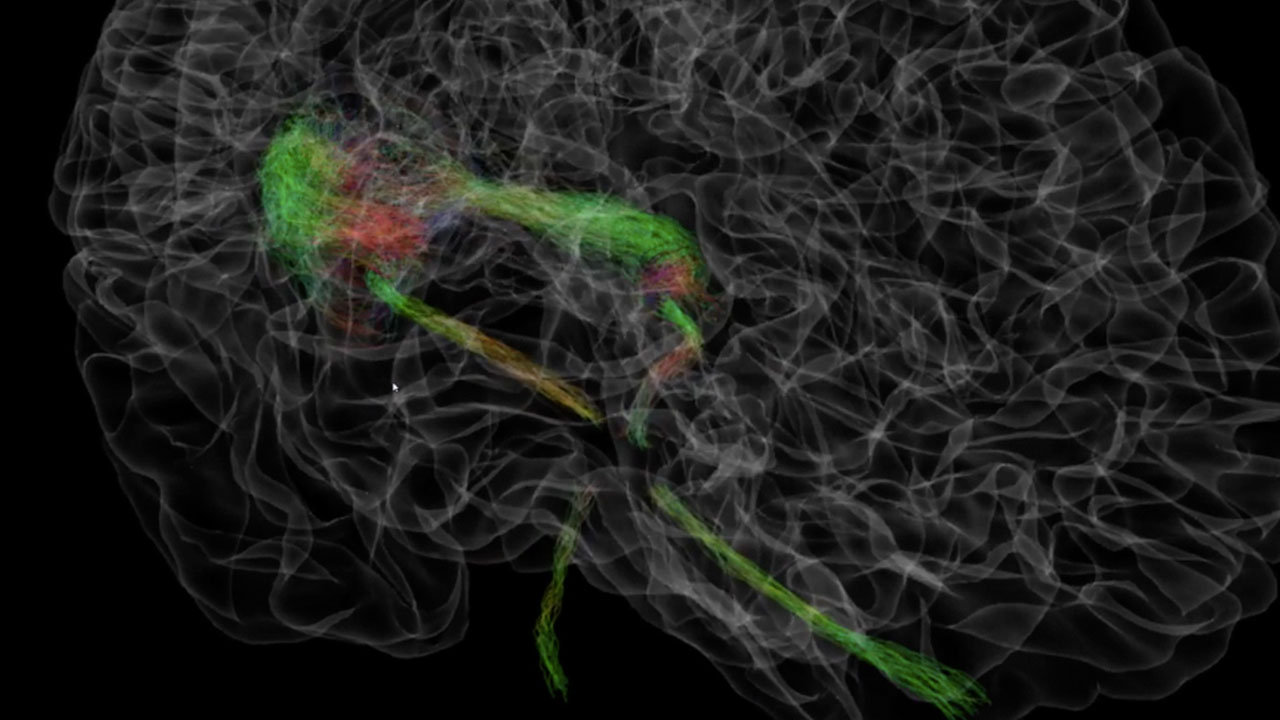 Virtual Brain With Oculus Rift (1)