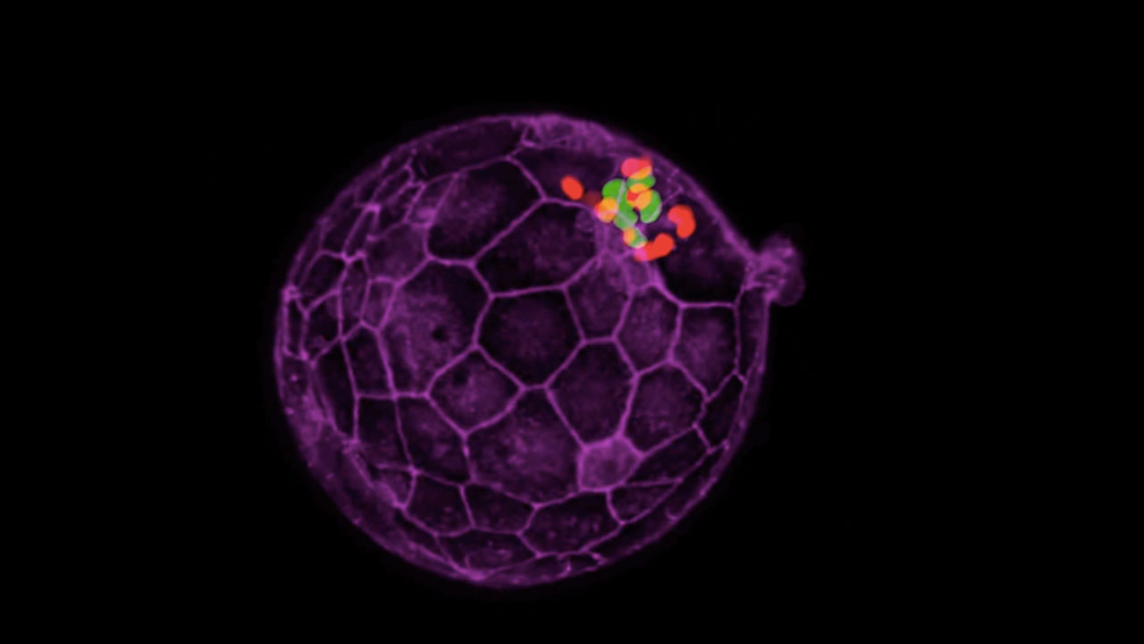 Hatching of the Human Blastocyst at Day 6