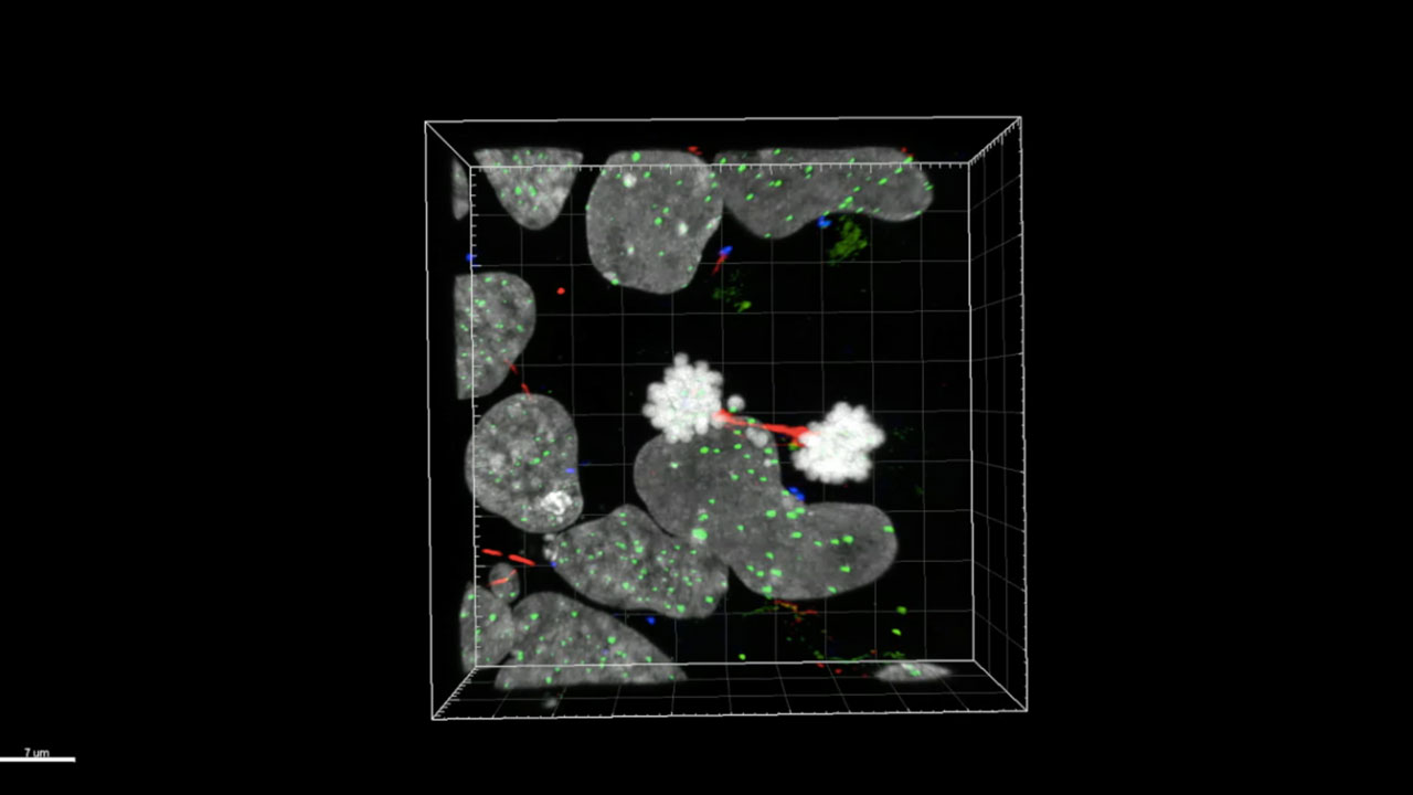 Huntington’s disease cell division phenotype