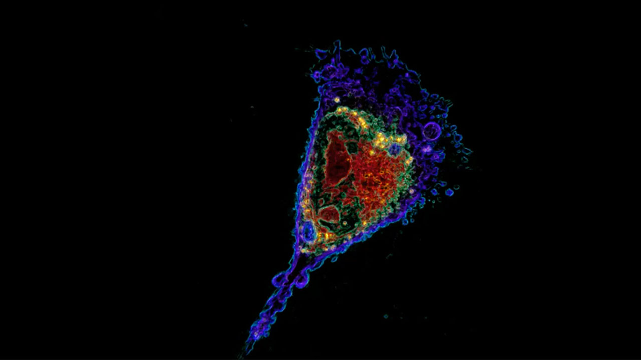 Apoptosis (Programmed Cell Death) - Live and in 3D