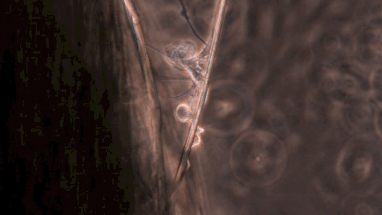 Aseptic Requiem (Requiem Aseptisé)