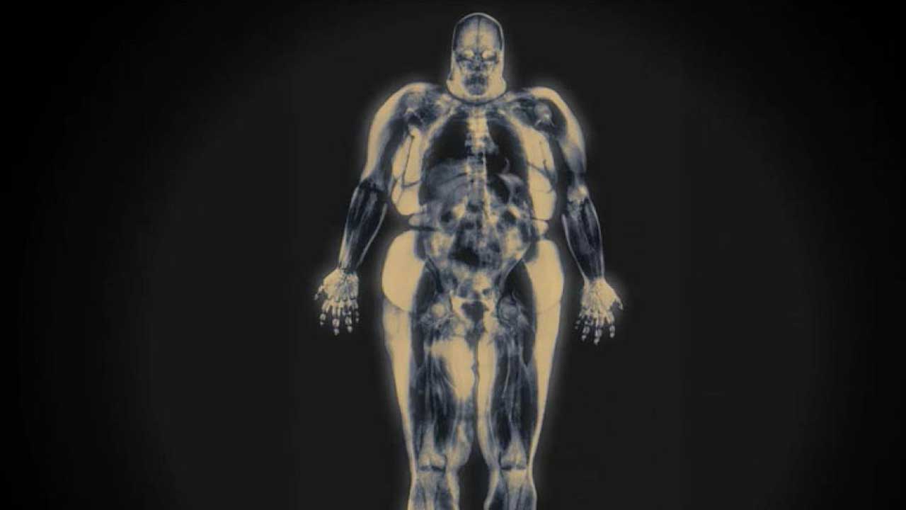 A Brief History of Fat, And Why We Hate It