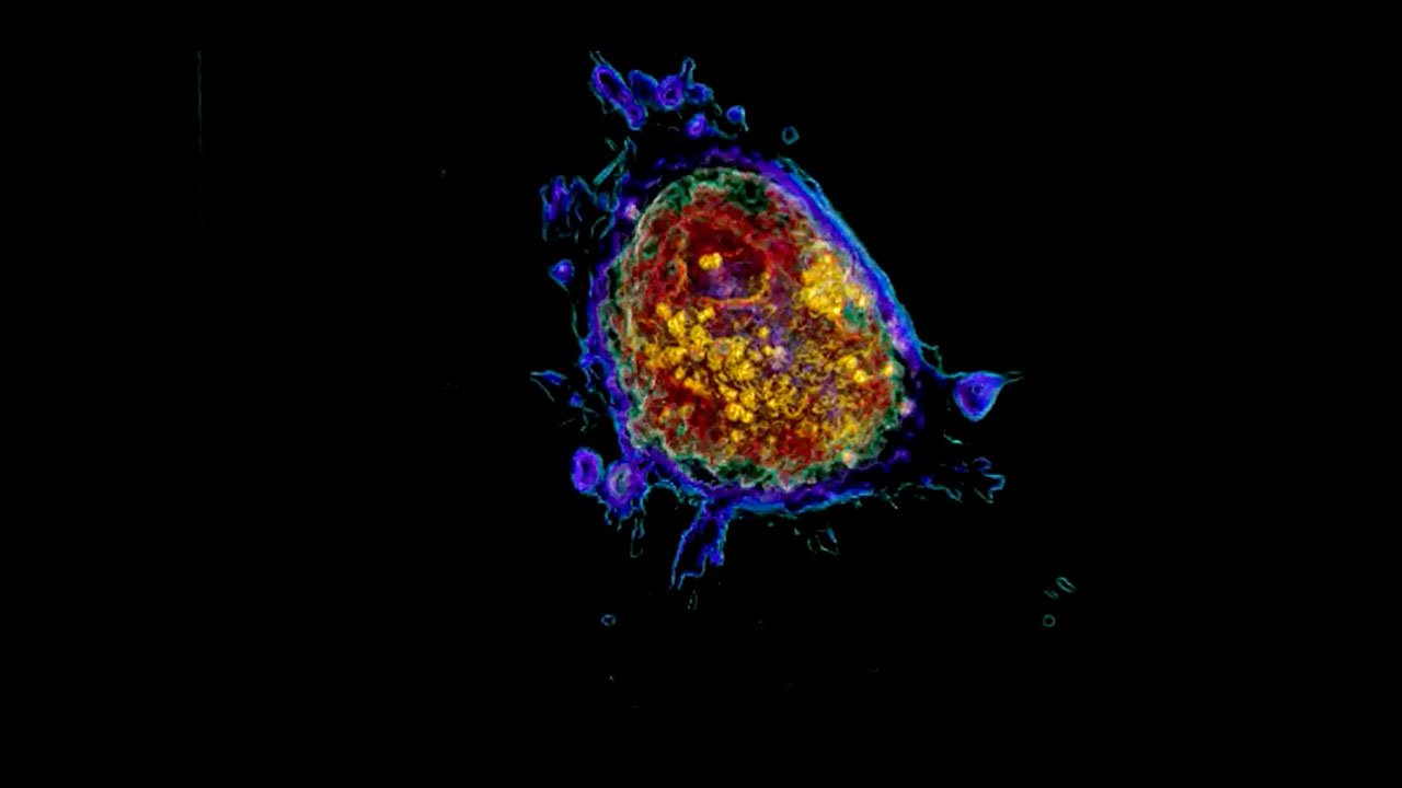 Apoptosis (Programmed Cell Death) - Live and in 3D