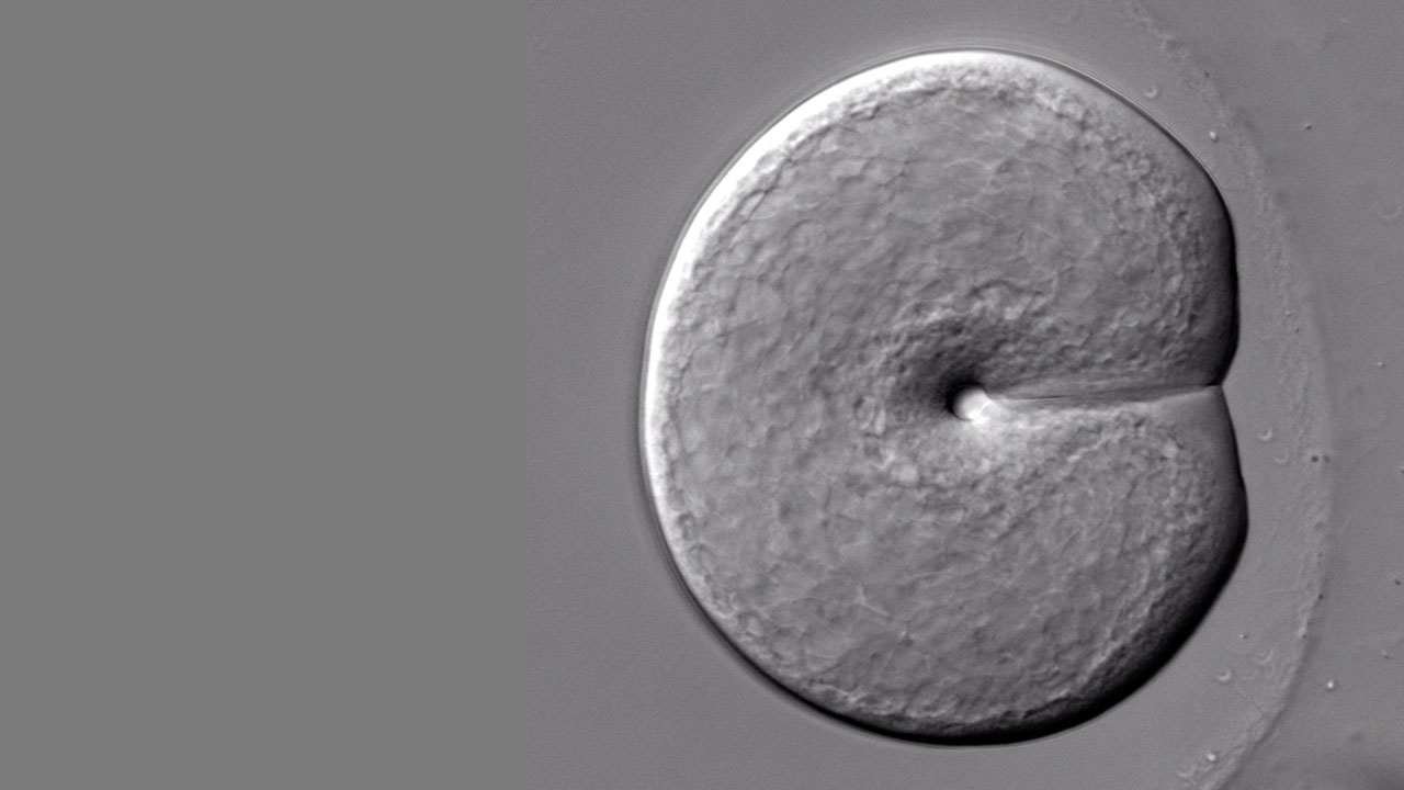 The first cell division of the ctenophore (comb jelly)
