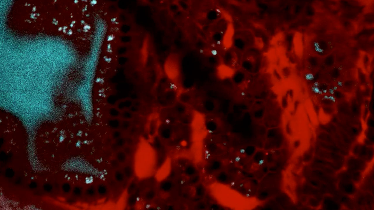 A Fluorescently-Stained Liver in a Developing Zebrafish