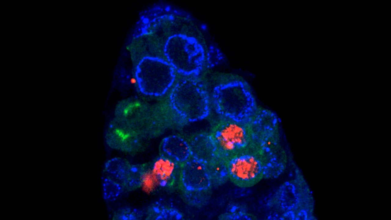 Stem Cell Ways to Make a Fruit Fly