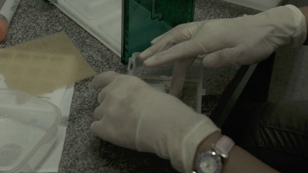 Loading Proteins On a Western Blot