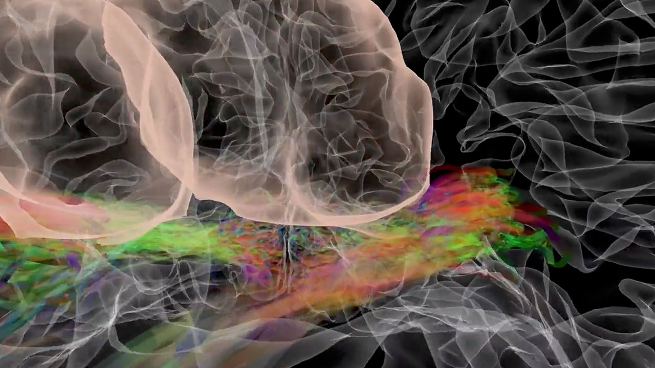 Virtual Brain: Visual Pathways