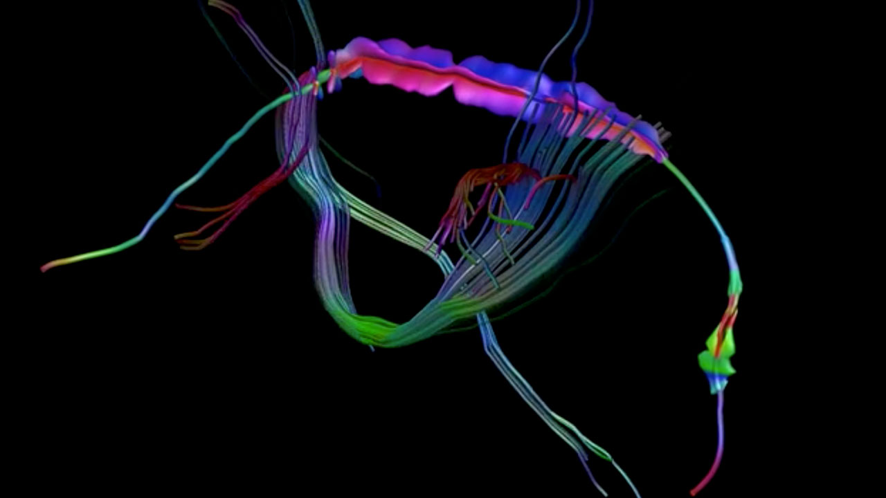 Visualizing Crossing Fibers
