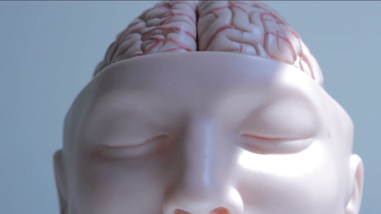 Brain with Arteries on Head Model