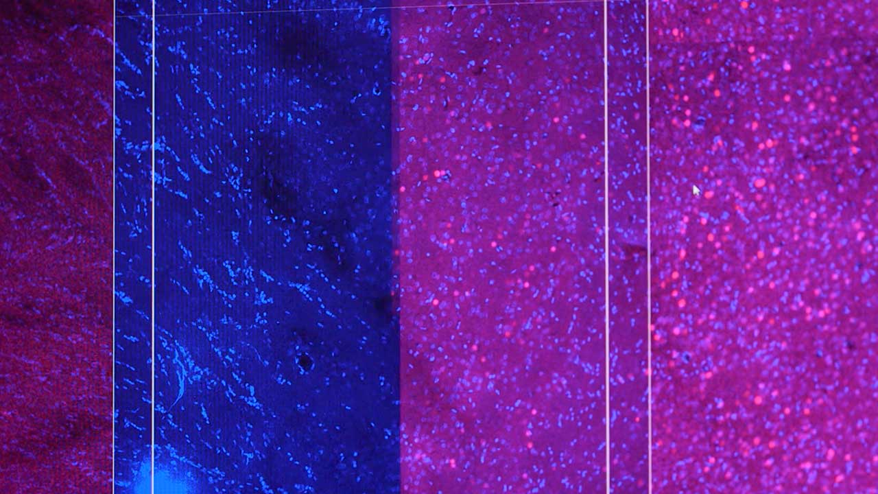 Rat Amygdala Slices Under Confocal Microscopy