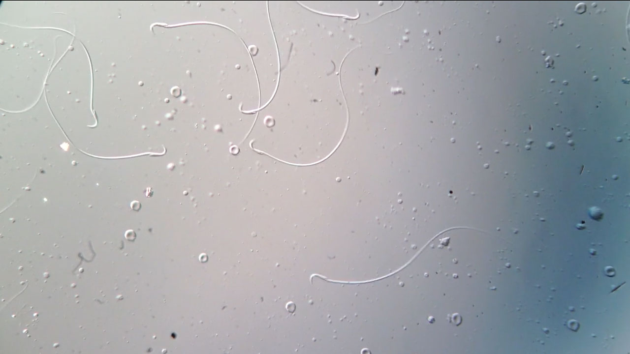 Sperm with hooks