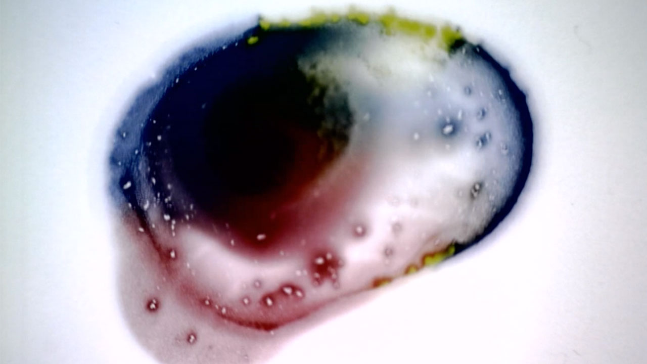 Bacterial Super Colony