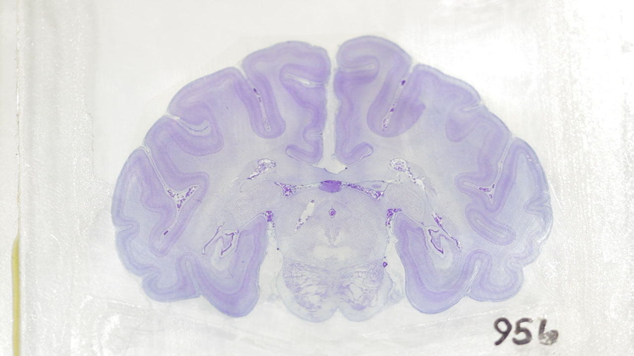 Into the Blues with a Mouse Brain Slice