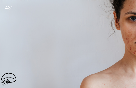 Immunoglobulin G, IgG Test