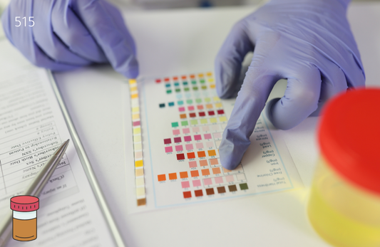 Leptospiral IgM, Serum Test