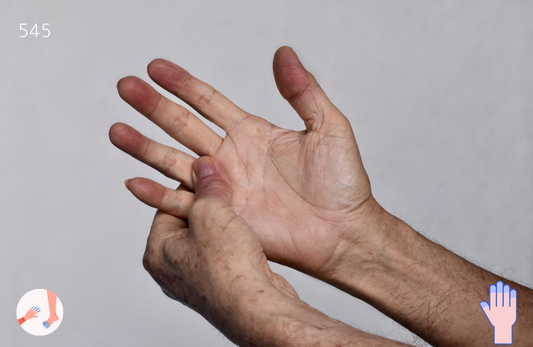 Methemoglobin Reductase Test