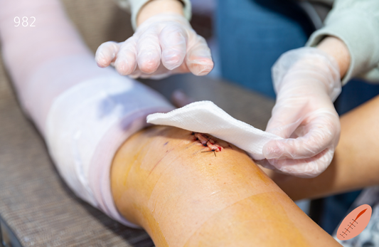 غيار جرح كامل السماكة (الدرجة الثالثة)