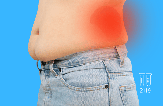 البيلة الألبومينية الدقيقة (بول 24 ساعة)