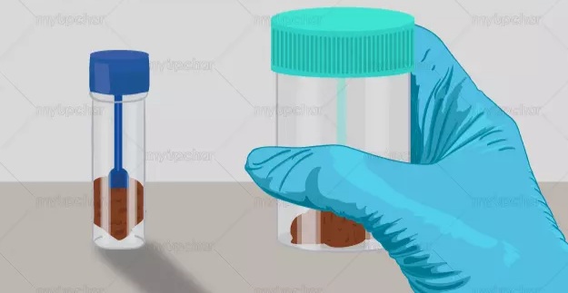 Rota Virus screening Ag STOOL