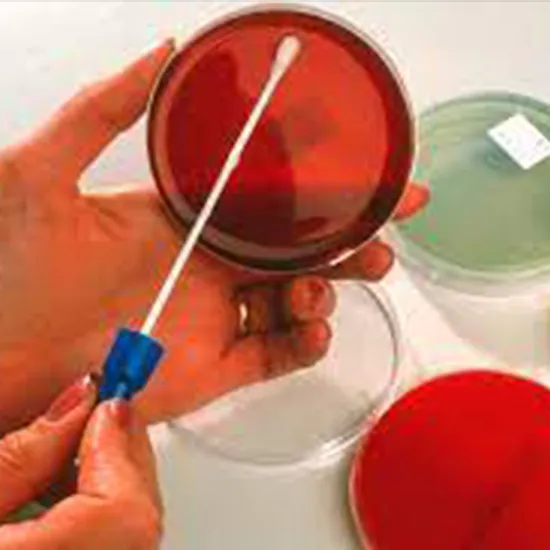 Culture & Sensitivity - Wound Swab