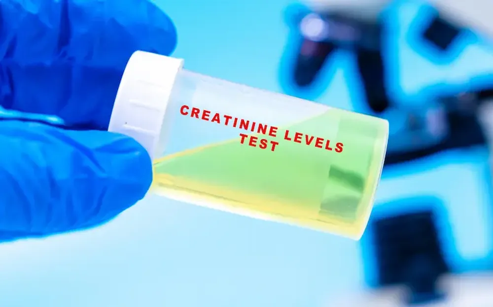 Creatinine Clearance