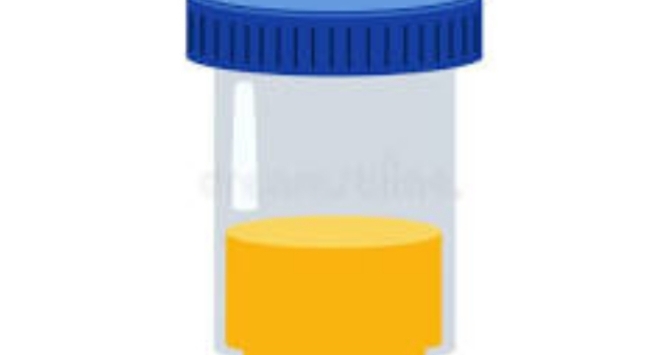 Total Protein in 24 hrs Urine