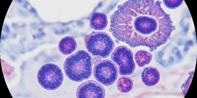 الخلايا اللمفاوية CD8