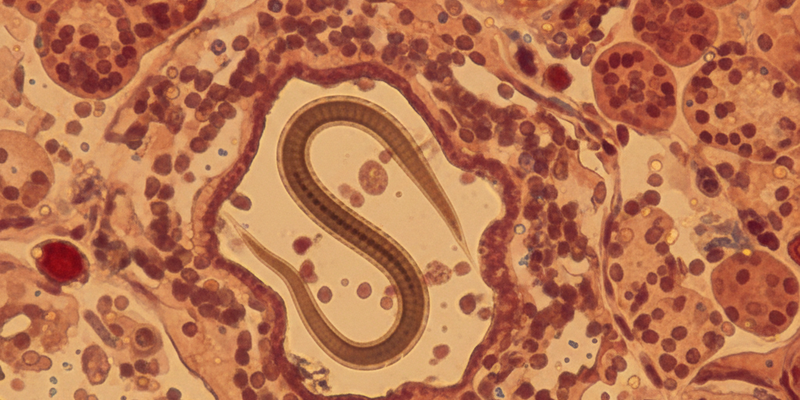 داء الأسطوانيات